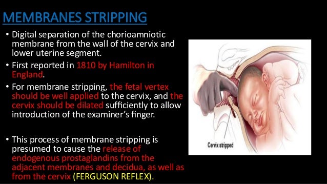 strip membranes labor Nicole narrain sex tape